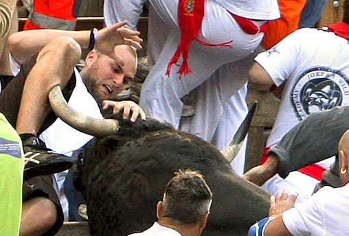Bull Gored Leg